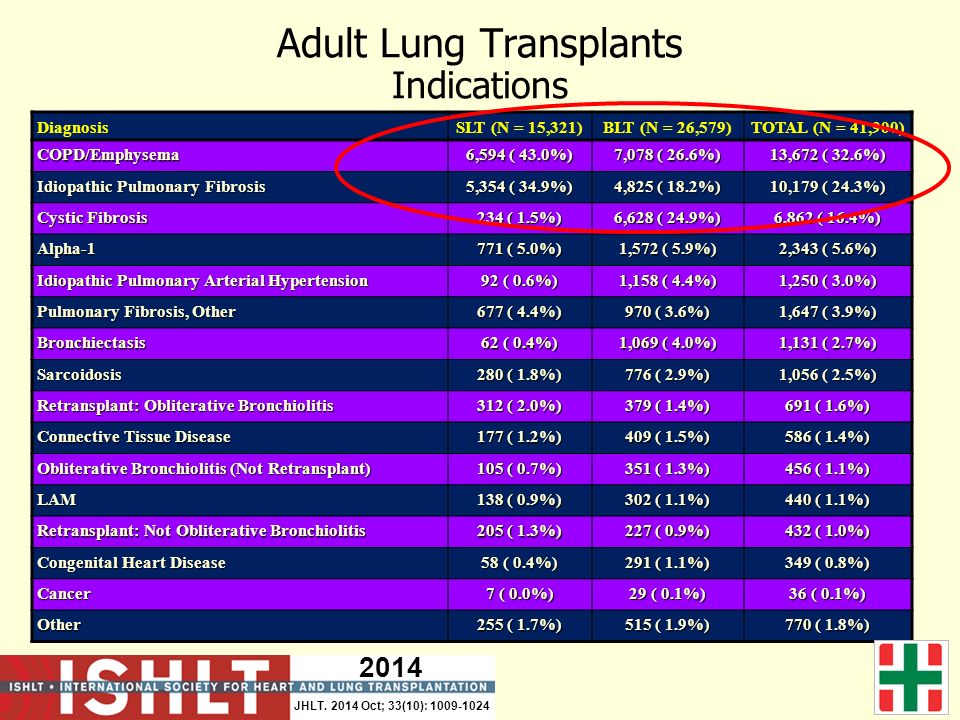 adult lung transplants adult lung transplants